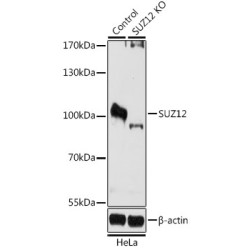 Polycomb Protein SUZ12 (SUZ12) Antibody