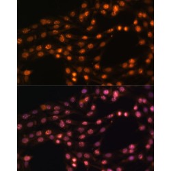 Polycomb Protein SUZ12 (SUZ12) Antibody