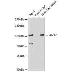 Polycomb Protein SUZ12 (SUZ12) Antibody