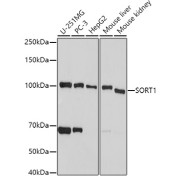 Western blot analysis of various lysates using SORT1 Antibody at 1/500 dilution. Secondary antibody: HRP-conjugated Goat anti-Rabbit IgG (H+L) at 1/10000 dilution. Lysates/proteins: 25 µg per lane. Blocking buffer: 3% nonfat dry milk in TBST. Exposure time: 15s.