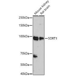 Sortilin 1 (SORT1) Antibody