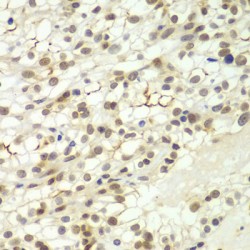 LIM/Homeobox Protein Lhx4 (LHX4) Antibody