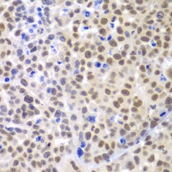 LIM/Homeobox Protein Lhx4 (LHX4) Antibody