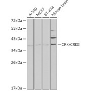 Western blot analysis of various lysates using CRK/CRKII Antibody at 1/1000 dilution. Secondary antibody: HRP-conjugated Goat anti-Rabbit IgG (H+L) at 1/10000 dilution. Lysates/proteins: 25 µg per lane. Blocking buffer: 3% nonfat dry milk in TBST.