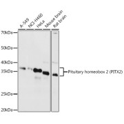 Western blot analysis of various lysates using Pituitary homeobox 2 (PITX2) Antibody at 1/1000 dilution. Secondary antibody: HRP-conjugated Goat anti-Rabbit IgG (H+L) at 1/10000 dilution. Lysates/proteins: 25 µg per lane. Blocking buffer: 3% nonfat dry milk in TBST. Exposure time: 90s.