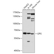 Western blot analysis of various lysates using LIPG Antibody at 1/500 dilution. Secondary antibody: HRP-conjugated Goat anti-Rabbit IgG (H+L) at 1/10000 dilution. Lysates/proteins: 25 µg per lane. Blocking buffer: 3% nonfat dry milk in TBST. Exposure time: 90s.