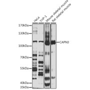 Western blot analysis of various lysates using CAPN3 Antibody at 1/1000 dilution. Secondary antibody: HRP-conjugated Goat anti-Rabbit IgG (H+L) at 1/10000 dilution. Lysates/proteins: 25 µg per lane. Blocking buffer: 3% nonfat dry milk in TBST. Exposure time: 15s.