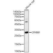 Western blot analysis of various lysates, using CRYBB1 Antibody at 1/1000 dilution. Secondary antibody: HRP-conjugated Goat anti-Rabbit IgG (H+L) at 1/10000 dilution. Lysates/proteins: 25 µg per lane. Blocking buffer: 3% nonfat dry milk in TBST. Exposure time: 180s.