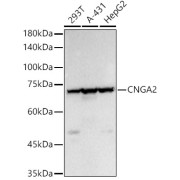 Western blot analysis of various lysates, using CNGA2 Antibody at 1/400 dilution. Secondary antibody: HRP-conjugated Goat anti-Rabbit IgG (H+L) at 1/10000 dilution. Lysates/proteins: 25 µg per lane. Blocking buffer: 3% nonfat dry milk in TBST. Exposure time: 30s.