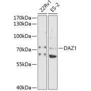 Western blot analysis of various lysates using DAZ1 Antibody at 1/1000 dilution. Secondary antibody: HRP-conjugated Goat anti-Rabbit IgG (H+L) at 1/10000 dilution. Lysates/proteins: 25 µg per lane. Blocking buffer: 3% nonfat dry milk in TBST. Exposure time: 90s.