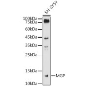 Western blot analysis of lysates from SH-SY5Y cells, using MGP Antibody at 1/1000 dilution. Secondary antibody: HRP-conjugated Goat anti-Rabbit IgG (H+L) at 1/10000 dilution. Lysates/proteins: 25 µg per lane. Blocking buffer: 3% nonfat dry milk in TBST. Exposure time: 180s.