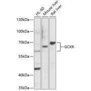 Western blot analysis of lysates from Rat liver using GCKR Antibody at 1/1000 dilution incubated overnight at 4°C. Secondary antibody: HRP-conjugated Goat anti-Rabbit IgG (H+L) at 1/10000 dilution. Lysates/proteins: 25 µg per lane. Blocking buffer: 3% nonfat dry milk in TBST. Detection: ECL Basic Kit (RM00020) Exposure time: 90 s.