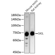 Western blot analysis of various lysates using SKIL Antibody at 1/1000 dilution. Secondary antibody: HRP-conjugated Goat anti-Rabbit IgG (H+L) at 1/10000 dilution. Lysates/proteins: 25 µg per lane. Blocking buffer: 3% nonfat dry milk in TBST. Exposure time: 30s.