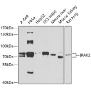 Western blot analysis of various lysates using IRAK2 Antibody at 1/1000 dilution. Secondary antibody: HRP-conjugated Goat anti-Rabbit IgG (H+L) at 1/10000 dilution. Lysates/proteins: 25 µg per lane. Blocking buffer: 3% nonfat dry milk in TBST. Exposure time: 90s.