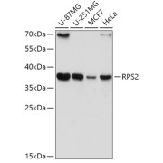 Western blot analysis of various lysates using RPS2 Antibody at 1/1000 dilution. Secondary antibody: HRP-conjugated Goat anti-Rabbit IgG (H+L) at 1/10000 dilution. Lysates/proteins: 25 µg per lane. Blocking buffer: 3% nonfat dry milk in TBST. Exposure time: 15s.