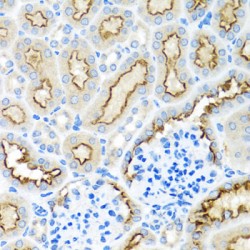 Ribosomal Protein S2 (RPS2) Antibody