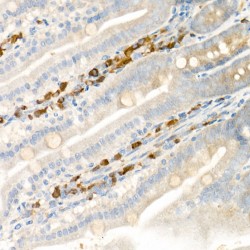 Polyunsaturated Fatty Acid Lipoxygenase ALOX15 (ALOX15) Antibody