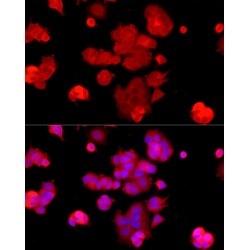 Polyunsaturated Fatty Acid Lipoxygenase ALOX15 (ALOX15) Antibody