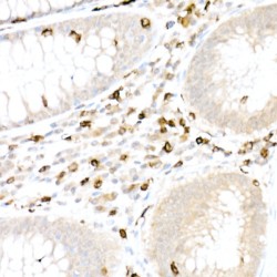 T-Cell Surface Glycoprotein CD5 (CD5) Antibody