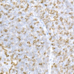 T-Cell Surface Glycoprotein CD5 (CD5) Antibody