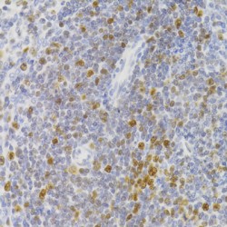 Nuclear Autoantigenic Sperm Protein (NASP) Antibody