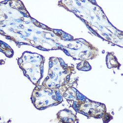 Solute Carrier Family 2, Facilitated Glucose Transporter Member 1 (SLC2A1) Antibody