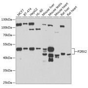 Western blot analysis of various lysates using P2RX2 Antibody at 1/1000 dilution. Secondary antibody: HRP-conjugated Goat anti-Rabbit IgG (H+L) at 1/10000 dilution. Lysates/proteins: 25 µg per lane. Blocking buffer: 3% nonfat dry milk in TBST. Exposure time: 90s.