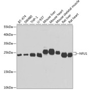 Western blot analysis of various lysates using NFU1 Antibody at 1/1000 dilution. Secondary antibody: HRP-conjugated Goat anti-Rabbit IgG (H+L) at 1/10000 dilution. Lysates/proteins: 25 µg per lane. Blocking buffer: 3% nonfat dry milk in TBST. Exposure time: 30s.