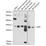 Western blot analysis of various lysates using APIP Antibody at 1/1000 dilution. Secondary antibody: HRP-conjugated Goat anti-Rabbit IgG (H+L) at 1/10000 dilution. Lysates/proteins: 25 µg per lane. Blocking buffer: 3% nonfat dry milk in TBST. Exposure time: 10s.