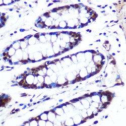 Methylthioribulose-1-Phosphate Dehydratase (APIP) Antibody