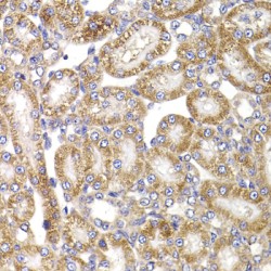 Anaphase Promoting Complex Subunit 5 (ANAPC5) Antibody