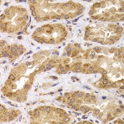 Anaphase Promoting Complex Subunit 5 (ANAPC5) Antibody