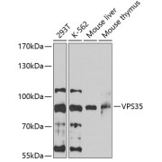 Western blot analysis of various lysates using VPS35 Antibody at 1/1000 dilution. Secondary antibody: HRP-conjugated Goat anti-Rabbit IgG (H+L) at 1/10000 dilution. Lysates/proteins: 25 µg per lane. Blocking buffer: 3% nonfat dry milk in TBST. Exposure time: 60s.