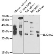 Western blot analysis of various lysates using IL22RA2 Antibody at 1/1000 dilution. Secondary antibody: HRP-conjugated Goat anti-Rabbit IgG (H+L) at 1/10000 dilution. Lysates/proteins: 25 µg per lane. Blocking buffer: 3% nonfat dry milk in TBST. Exposure time: 30s.