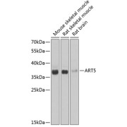 Western blot analysis of various lysates using ART5 Antibody at 1/1000 dilution. Secondary antibody: HRP-conjugated Goat anti-Rabbit IgG (H+L) at 1/10000 dilution. Lysates/proteins: 25 µg per lane. Blocking buffer: 3% nonfat dry milk in TBST. Exposure time: 30s.