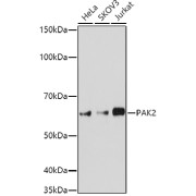 Western blot analysis of various lysates using PAK2 Antibody at 1/1000 dilution. Secondary antibody: HRP-conjugated Goat anti-Rabbit IgG (H+L) at 1/10000 dilution. Lysates/proteins: 25 µg per lane. Blocking buffer: 3% nonfat dry milk in TBST. Exposure time: 90s.