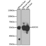 Western blot analysis of various lysates using ADCK3 Antibody at 1/1000 dilution. Secondary antibody: HRP-conjugated Goat anti-Rabbit IgG (H+L) at 1/10000 dilution. Lysates/proteins: 25 µg per lane. Blocking buffer: 3% nonfat dry milk in TBST. Exposure time: 30s.