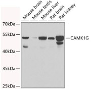 Western blot analysis of various lysates using CAMK1G Antibody at 1/1000 dilution. Secondary antibody: HRP-conjugated Goat anti-Rabbit IgG (H+L) at 1/10000 dilution. Lysates/proteins: 25 µg per lane. Blocking buffer: 3% nonfat dry milk in TBST. Exposure time: 30s.