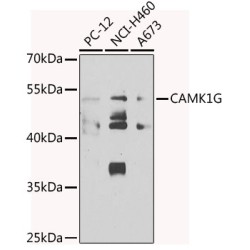 Calcium/calmodulin Dependent Protein Kinase IG (CAMK1G) Antibody