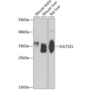 Western blot analysis of various lysates using SULT1E1 Antibody at 1/1000 dilution. Secondary antibody: HRP-conjugated Goat anti-Rabbit IgG (H+L) at 1/10000 dilution. Lysates/proteins: 25 µg per lane. Blocking buffer: 3% nonfat dry milk in TBST. Exposure time: 90s.