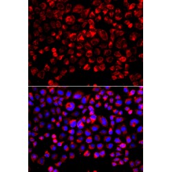 Sulfotransferase Family 1E Member 1 (SULT1E1) Antibody