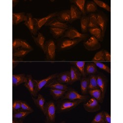 Disheveled Associated Activator of Morphogenesis 2 (DAAM2) Antibody