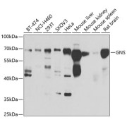 Western blot analysis of various lysates using GNS Antibody at 1/1000 dilution. Secondary antibody: HRP-conjugated Goat anti-Rabbit IgG (H+L) at 1/10000 dilution. Lysates/proteins: 25 µg per lane. Blocking buffer: 3% nonfat dry milk in TBST. Exposure time: 30s.