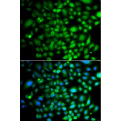 Protein Tyrosine Kinase 6 (PTK6) Antibody