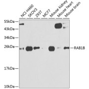 Western blot analysis of lysates from wild type (WT) and RAB1B knockout (KO) HeLa cells using [KO Validated] RAB1B Antibody RAB1B Antibody at 1/1000 dilution. Secondary antibody: HRP-conjugated Goat anti-Rabbit IgG (H+L) at 1/10000 dilution. Lysates/proteins: 25 µg per lane. Blocking buffer: 3% nonfat dry milk in TBST. Exposure time: 1s.