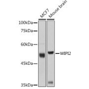 Western blot analysis of various lysates using WIPI2 Antibody at 1/1000 dilution. Secondary antibody: HRP-conjugated Goat anti-Rabbit IgG (H+L) at 1/10000 dilution. Lysates/proteins: 25 µg per lane. Blocking buffer: 3% nonfat dry milk in TBST. Exposure time: 3s.