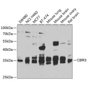 Western blot analysis of various lysates using CBR3 Antibody at 1/1000 dilution. Secondary antibody: HRP-conjugated Goat anti-Rabbit IgG (H+L) at 1/10000 dilution. Lysates/proteins: 25 µg per lane. Blocking buffer: 3% nonfat dry milk in TBST. Exposure time: 30s.