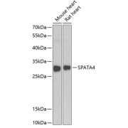 Western blot analysis of various lysates using SPATA4 Antibody at 1/1000 dilution. Secondary antibody: HRP-conjugated Goat anti-Rabbit IgG (H+L) at 1/10000 dilution. Lysates/proteins: 25 µg per lane. Blocking buffer: 3% nonfat dry milk in TBST. Exposure time: 90s.
