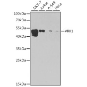 Western blot analysis of various lysates using [KO Validated] VRK1 Antibody at 1/1000 dilution. Secondary antibody: HRP-conjugated Goat anti-Rabbit IgG (H+L) at 1/10000 dilution. Lysates/proteins: 25 µg per lane. Blocking buffer: 3% nonfat dry milk in TBST. Exposure time: 90s.