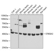 Western blot analysis of various lysates using ST8SIA2 Antibody at 1/1000 dilution. Secondary antibody: HRP-conjugated Goat anti-Rabbit IgG (H+L) at 1/10000 dilution. Lysates/proteins: 25 µg per lane. Blocking buffer: 3% nonfat dry milk in TBST. Exposure time: 30s.